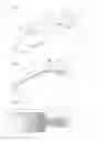 Fig. 02 - One piece flat device of for the drainage of aqueous humor from the eye