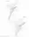 Fig. 05 - One piece flat device of for the drainage of aqueous humor from the eye