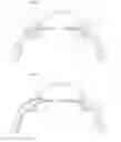 Fig. 08 - One piece flat device of for the drainage of aqueous humor from the eye