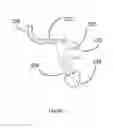 Fig. 04 - Device for protecting the human sensory hearing system while retaining quality sound