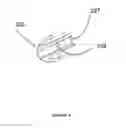 Fig. 05 - Device for protecting the human sensory hearing system while retaining quality sound