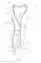 Fig. 02 - Nerve de-tensioning method and apparatus