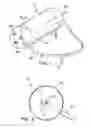 Fig. 02 - DEVICES FOR MOBILIZING THE HIP JOINT CAPSULE AND METHODS OF USING SAME