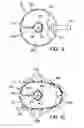 Fig. 09 - DEVICES FOR MOBILIZING THE HIP JOINT CAPSULE AND METHODS OF USING SAME