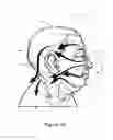 Fig. 04 - Head and neck compression therapy system