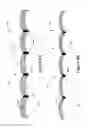 Fig. 12 - Static and dynamic compression therapy system