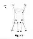 Fig. 13 - Adjustable compression garment