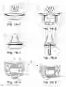 Fig. 02 - Vibrating Oral Comfort Device and Method of Assembly