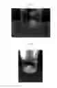 Fig. 06 - Polymeric Drug-Delivery Material, Method for Manufacturing Thereof and Method for Delivery of a Drug-Delivery Composition