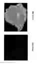 Fig. 20 - SYNTHETIC PLATELETS