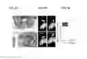 Fig. 09 - Methods for treating mendelian disorders of the epigenetic machinery