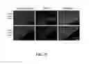 Fig. 34 - Methods for treating mendelian disorders of the epigenetic machinery