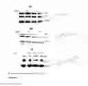 Fig. 17 - Selective androgen receptor degrader (SARD) ligands and methods of use thereof