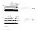 Fig. 18 - Selective androgen receptor degrader (SARD) ligands and methods of use thereof