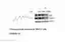 Fig. 20 - Selective androgen receptor degrader (SARD) ligands and methods of use thereof