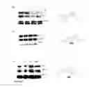 Fig. 33 - Selective androgen receptor degrader (SARD) ligands and methods of use thereof