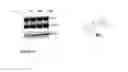 Fig. 34 - Selective androgen receptor degrader (SARD) ligands and methods of use thereof