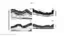 Fig. 08 - Methods of adipolysis and compositions useful therein