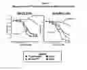 Fig. 02 - METHODS USING 3-(4-AMINO-1-OXO-1,3-DIHYDRO-ISOINDOL-2-YL)-PIPERIDINE-2,6-DIONE FOR TREATMENT OF CERTAIN LEUKEMIAS