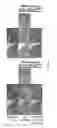 Fig. 43 - Nanoparticle compositions for sustained therapy