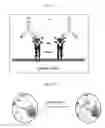 Fig. 02 - Treating bladder tumor cells using fibronectin attachment protein as a target