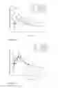 Fig. 09 - Wound dressing