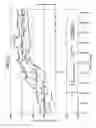 Fig. 41 - Dialysis system having inventory management including online dextrose mixing