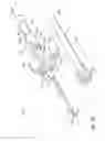 Fig. 22 - Tip protector for a safety catheter