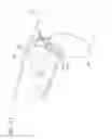 Fig. 19 - Dual chamber syringe with retractable needle