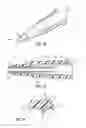 Fig. 09 - CONSTANT FORCE HOLD TIP PROTECTOR FOR A SAFETY CATHETER