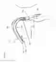 Fig. 10 - Device to reduce discomfort in the upper airway