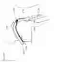 Fig. 20 - Device to reduce discomfort in the upper airway