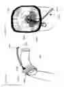 Fig. 23 - Device to reduce discomfort in the upper airway