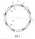 Fig. 04 - Large lumen guide catheter