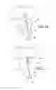 Fig. 11 - Catheter port