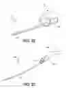 Fig. 17 - Catheter structure with improved support and related systems, methods, and devices