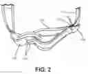 Fig. 03 - Support device for a drain system used in post-surgical procedures