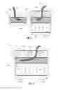 Fig. 03 - Devices and methods for providing focal cooling to the brain and spinal cord