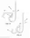 Fig. 03 - URETERAL STENT DRUG DELIVERY DEVICE, KIT, AND METHOD