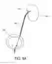 Fig. 06 - URETERAL STENT DRUG DELIVERY DEVICE, KIT, AND METHOD