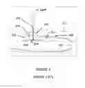 Fig. 03 - Vascular access ports and processes for their manufacture