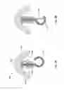 Fig. 10 - Fixation device for a subcutaneous electrode