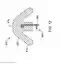 Fig. 13 - Fixation device for a subcutaneous electrode