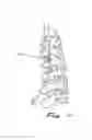 Fig. 10 - SPINAL CATHETER HAVING MULTIPLE OBSTRUCTION-CLEARING FEATURES