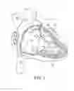Fig. 02 - Interventional medical systems, catheters, and methods