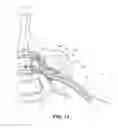 Fig. 19 - Methods for stimulating a dorsal root ganglion