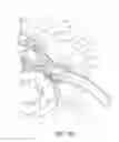 Fig. 22 - Methods for stimulating a dorsal root ganglion