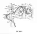 Fig. 28 - Methods for stimulating a dorsal root ganglion
