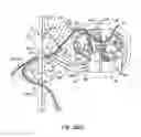 Fig. 29 - Methods for stimulating a dorsal root ganglion
