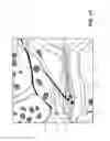 Fig. 30 - Methods for stimulating a dorsal root ganglion